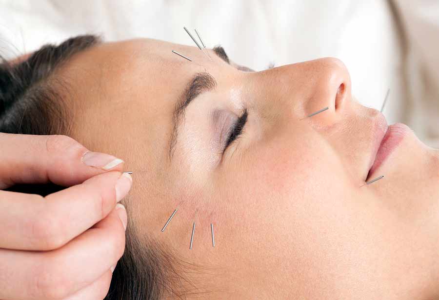 acupuncture-clinique-acupuncture-osteopathie-LAVAL